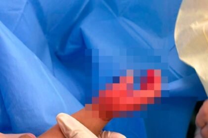 Tangan Anak yang Diasuhnya Melepuh, PMI di Yuen Long Ditangkap, Dituduh Kasus Penganiayaan