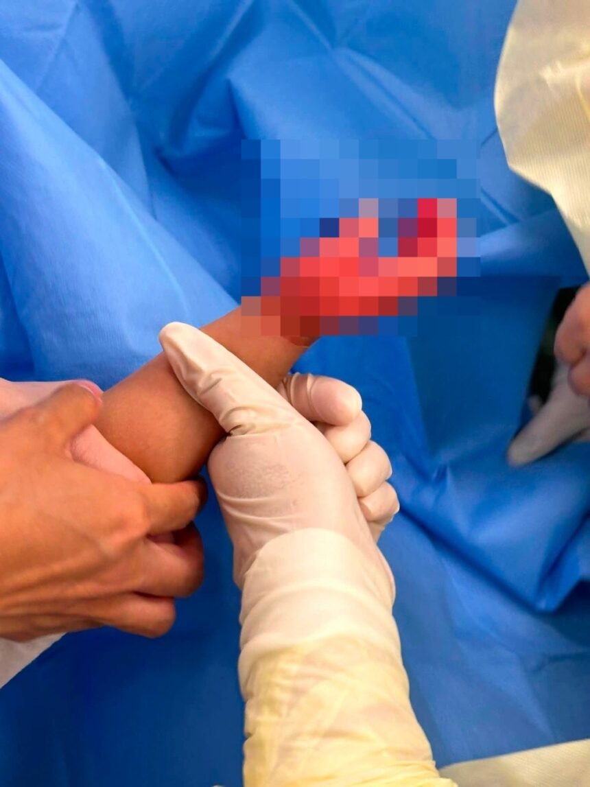 Tangan Anak yang Diasuhnya Melepuh, PMI di Yuen Long Ditangkap, Dituduh Kasus Penganiayaan
